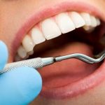 Estetik diş tedavileri ön dişlerde lamina, zirkonyum ve cam seramikler ila sağlanabilir.
