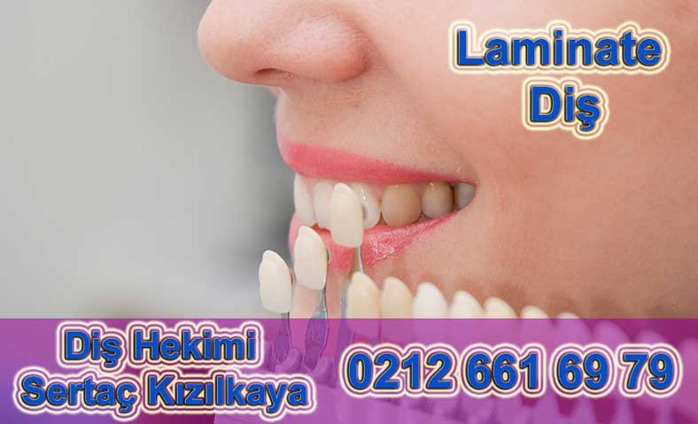 Lamina diş