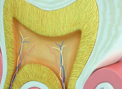 DİŞ AĞRISI VE KANAL TEDAVİSİ — Dr. Sertaç Kızılkaya