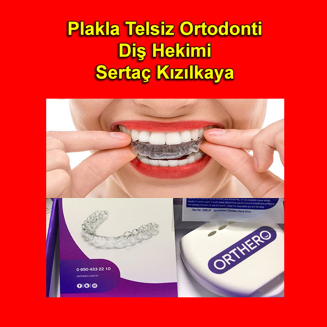 Plakla telsiz ortodonti