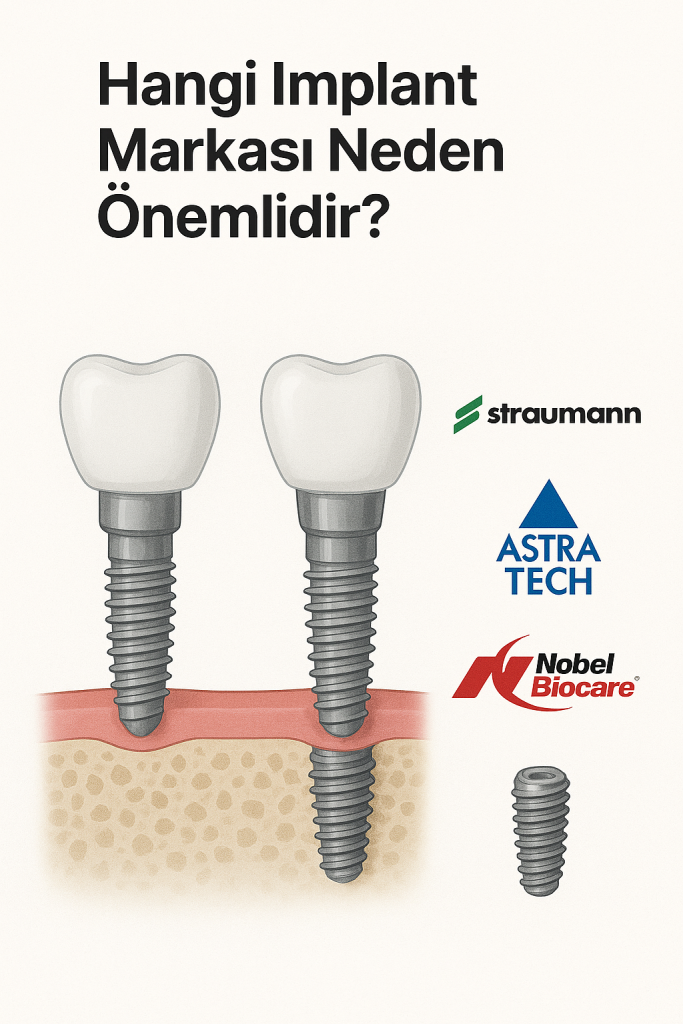 bego implant fiyatı