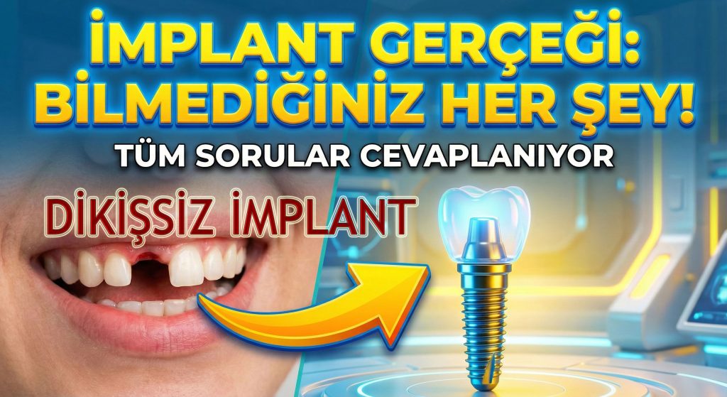 DİKİŞSİZ İMPLANT