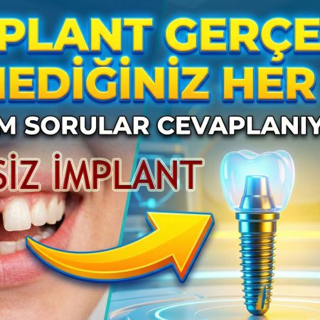 DİKİŞSİZ İMPLANT
