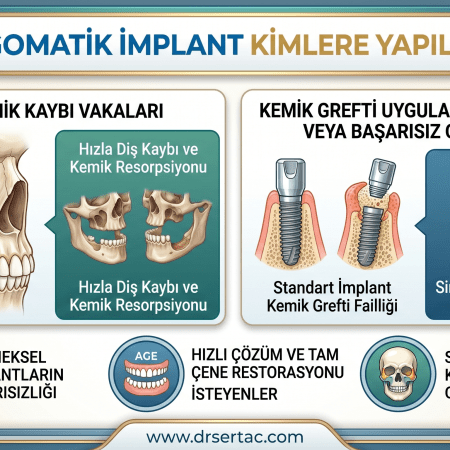 zigomatik implant kimlere yapılır